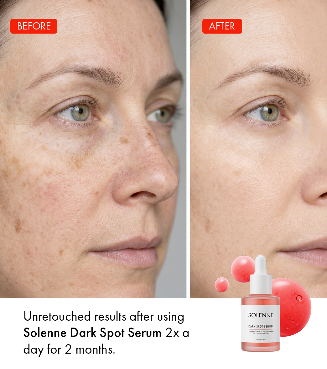 Dark Spot Correcting Serum